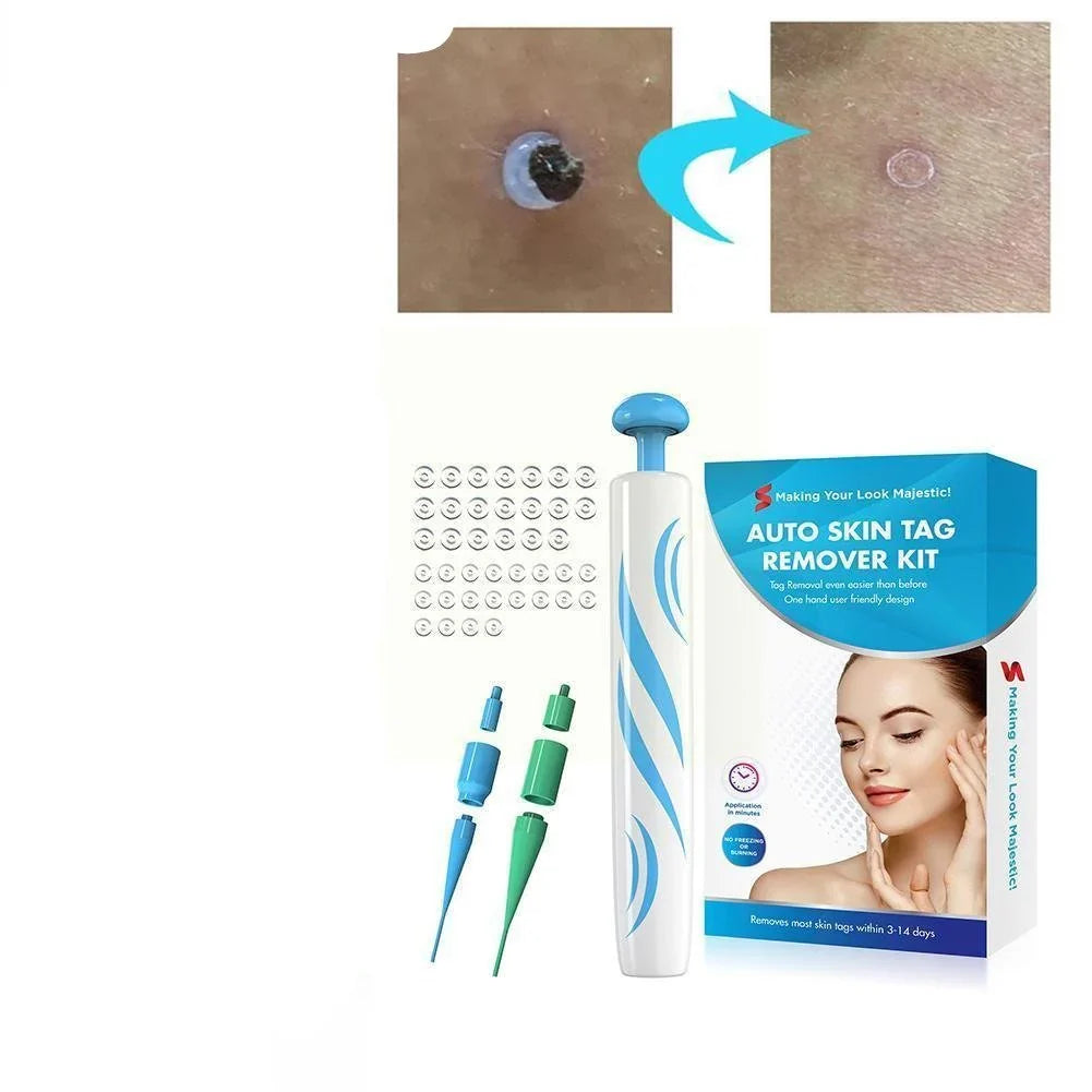 Skin Tag Removal Kit with Dual Spring Sizes