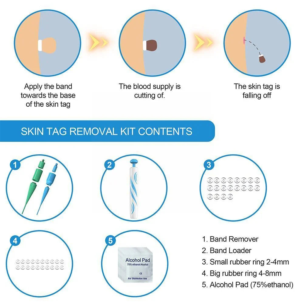 Skin Tag Removal Kit with Dual Spring Sizes