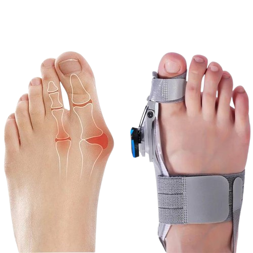 Adjustable Bunion Corrector with Twist Knob Control and Silicone Cushioning, Heel Strap