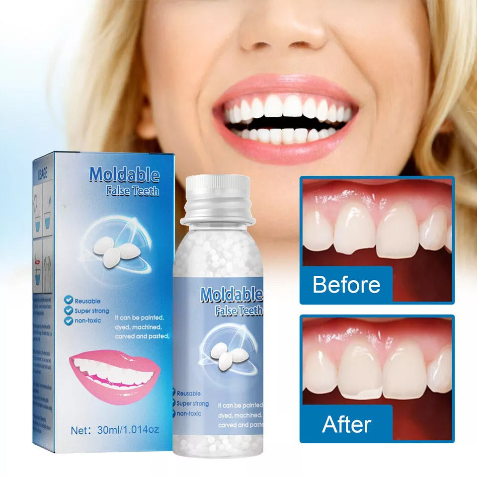 Moldable Tooth Repair Kit with Heat Activated Polymer Beads and Custom Fit Shaping