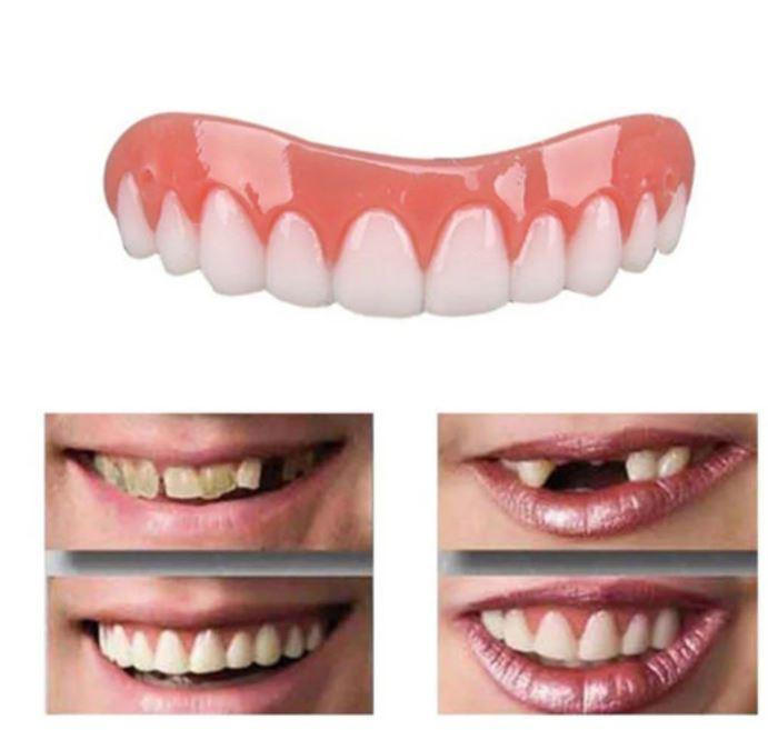 Removable Tooth Cover with Heat Molding and Dental Resin, Custom Fit