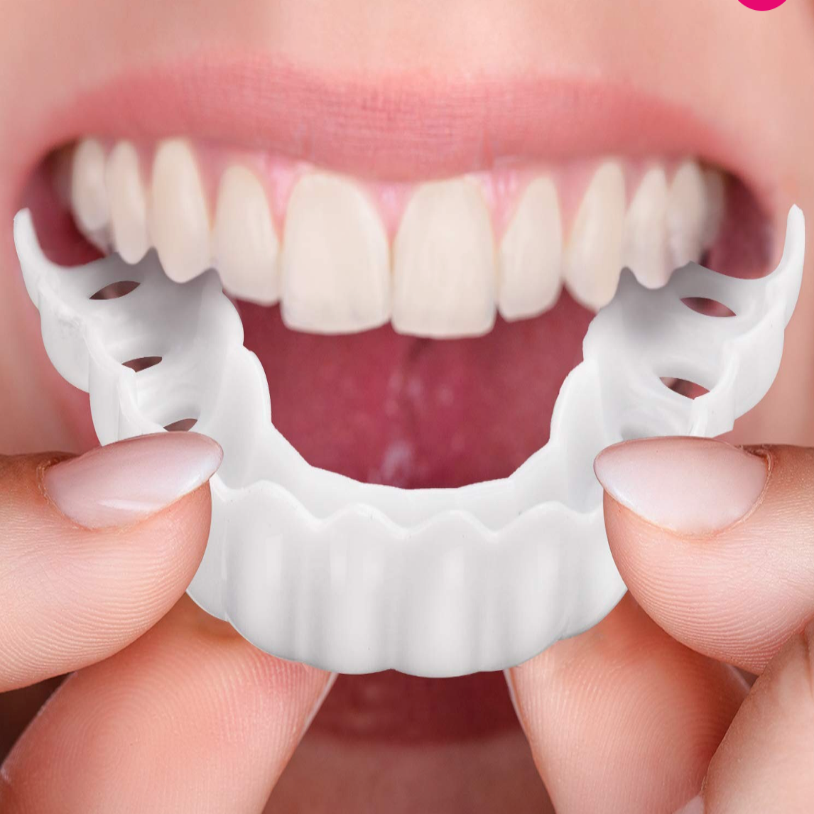 Snap-On Tooth Cover with Natural Color Polypropylene and Flexible Fit