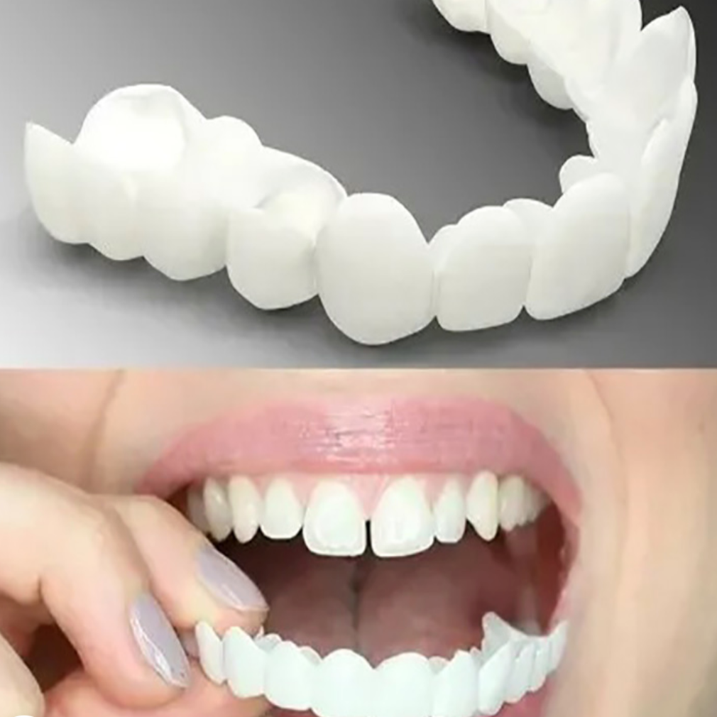 Snap-On Tooth Cover with Natural Color Polypropylene and Flexible Fit