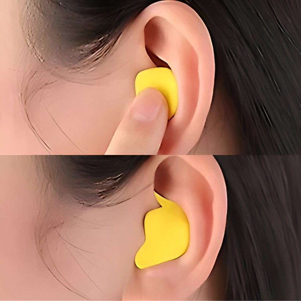 Moldable Silicone Earplugs with 95 Percent Noise Reduction and Hypoallergenic Design for Sleep