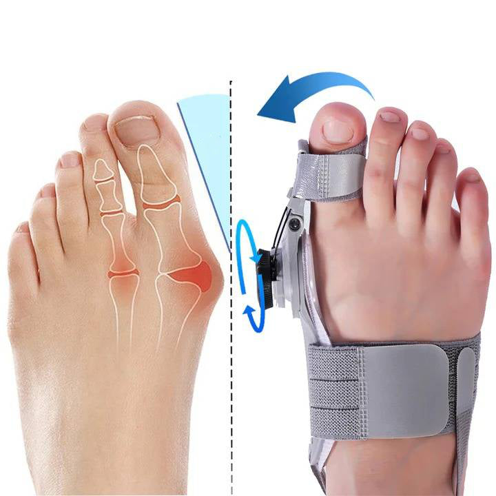 Adjustable Bunion Corrector with Twist Knob Control and Silicone Cushioning, Heel Strap